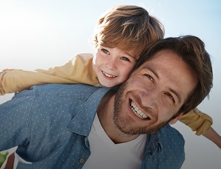 Exposure Bonding Image